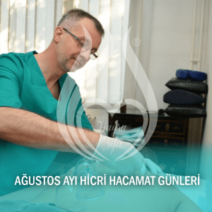 Ağustos 2018 Hicri Hacamat Günleri, Ağustos Ayı Hicri Hacamat Günleri, Hacamat Günleri