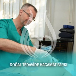 Doğal Tedavide Hacamat Farkı