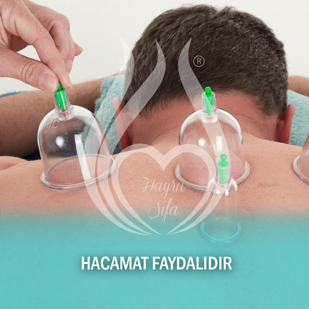 Hacamat Faydalıdır Hacamatın Faydaları