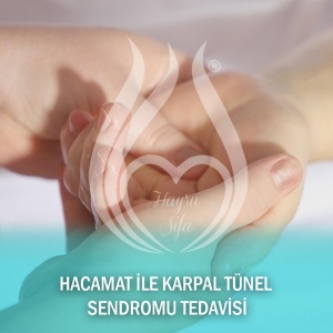 Hacamat ile Karpal Tünel Sendromu Tedavisi