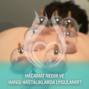 Hacamat Nedir? Hangi Hastalıklarda Uygulanır