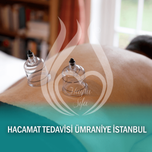 Hacamat Tedavisi Ümraniye İstanbul