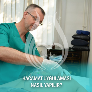 Hacamat Uygulaması Nasıl Yapılır