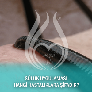 Sülük Uygulaması Hangi Hastalıklara Şifadır?