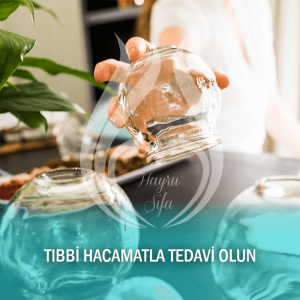 Tıbbi Hacamatla Tedavi Olun